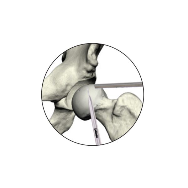 CROSSTRAC◊ Hip Guide System - slika 4