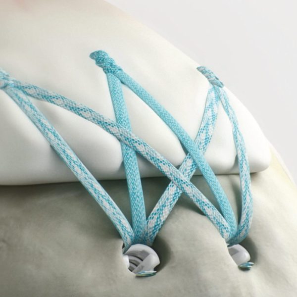 HEALICOIL◊ PK Suture Anchor - Image 2