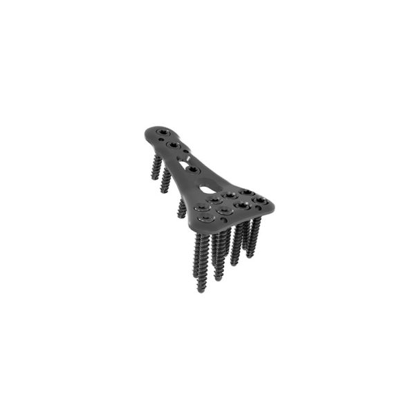 PROlock Radialne (Radius) Zaklepne Plošče (PRLP) - Image 3