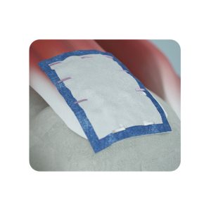 REGENETEN◊ Bioinduktivni implantat